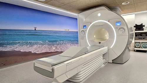 La resonancia multiparamétrica mejora la detección y caracterización del cáncer de próstata
